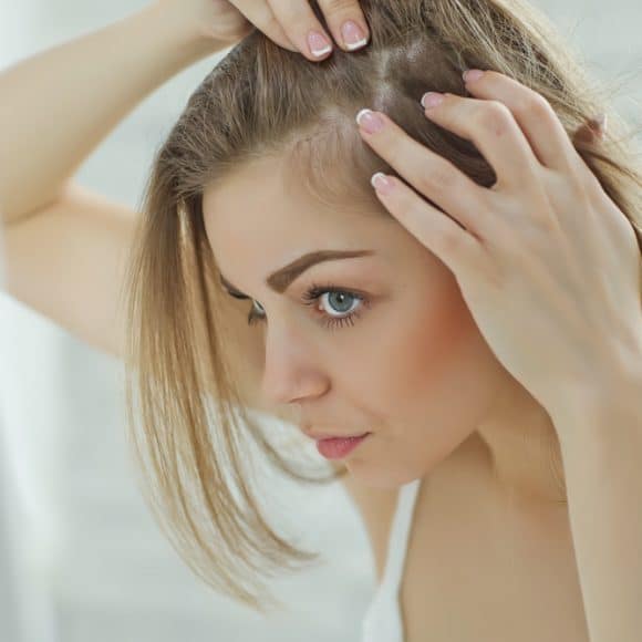 Calvície feminina: como cuidar deste problema? Calvície feminina: como cuidar deste problema?
