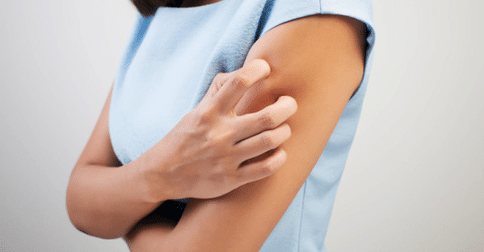 Dermatite Atópica: quais os sintomas e cuidados que você deve tomar