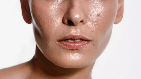 Guia básico para a pele oleosa: o que incluir e evitar na rotina?