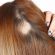 Cabelo caindo muito: até quando pode ser normal?