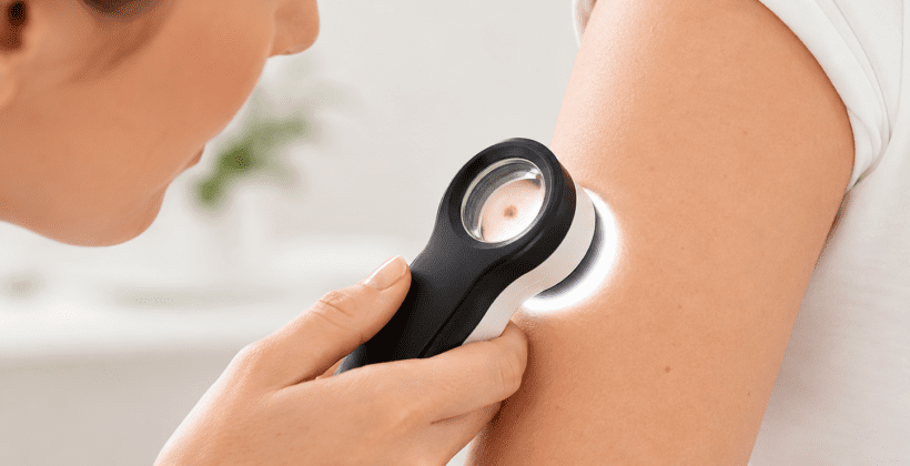 Dermatologistas Rio do Sul: conheça a equipe da Dermacenter Alto Vale