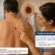 Pinta preta na pele: quando pode ser melanoma?