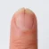 Unha rachada ao meio: o que pode ser e quando procurar dermatologista
