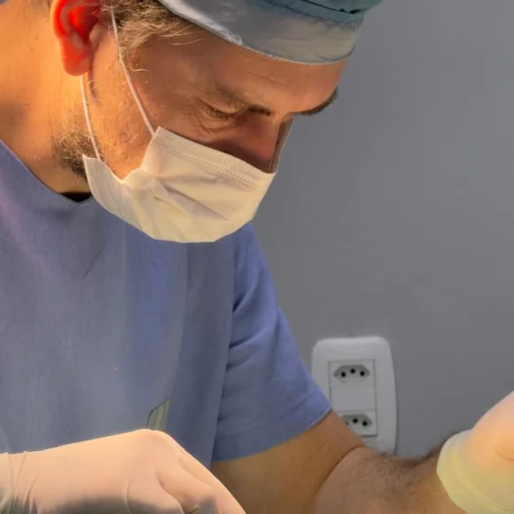 Quanto tempo dura a cirurgia de Mohs? Entenda as etapas