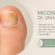 Micose de unha em Rio do Sul: como diagnosticar e tratar