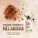 Vacina contra o melanoma: como funciona a nova terapia personalizada de mRNA